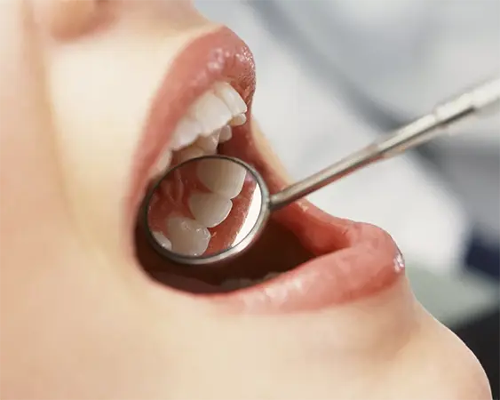 Canadian Dental Care Program